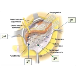 Article figure